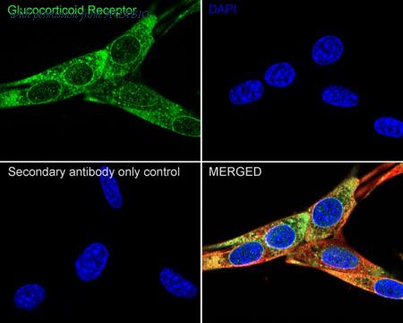 HUABIO ET1702-11 image 3