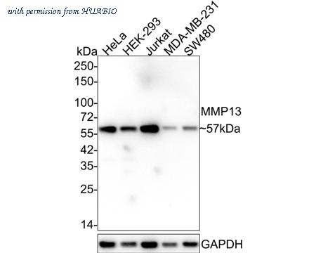 HUABIO ET1702-14 image 1