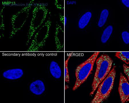 HUABIO ET1702-14 image 2