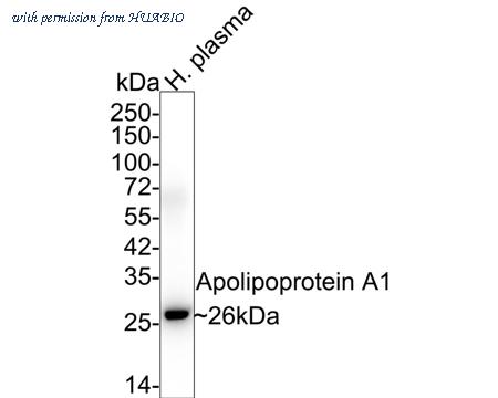 HUABIO ET1702-23 image 1