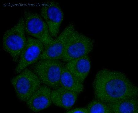 HUABIO ET1702-23 image 2