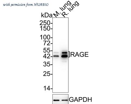 HUABIO ET1702-27 image 1