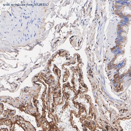 HUABIO ET1702-27 image 2