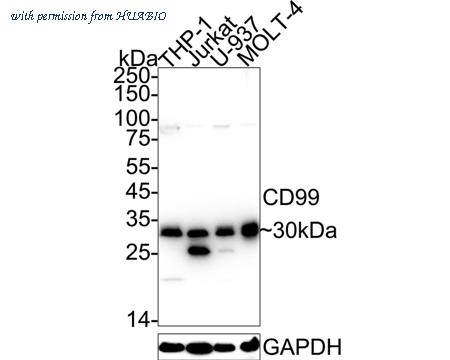 HUABIO ET1702-35 image 1