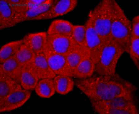 HUABIO ET1702-35 image 2