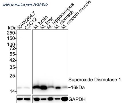 HUABIO ET1702-36 image 1