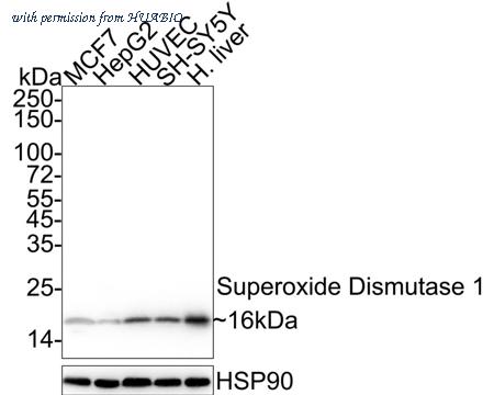 HUABIO ET1702-36 image 2