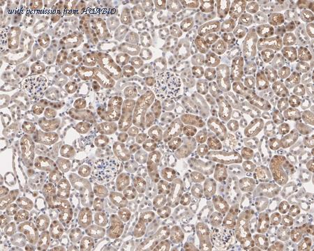 HUABIO ET1702-36 image 3