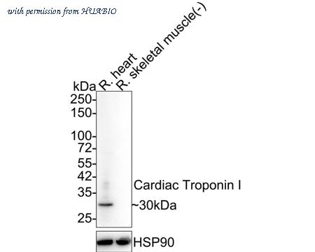 HUABIO ET1702-37 image 1