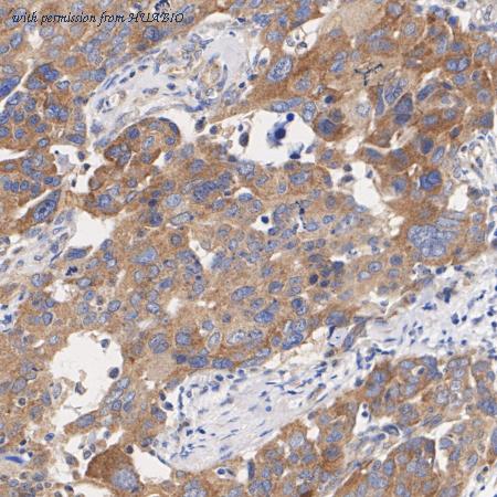 HUABIO ET1702-40 image 3