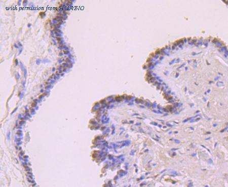 HUABIO ET1702-44 image 3