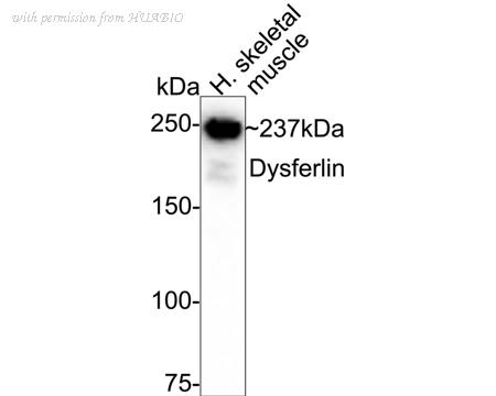 HUABIO ET1702-45 image 1