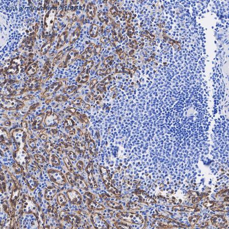 HUABIO ET1702-45 image 2