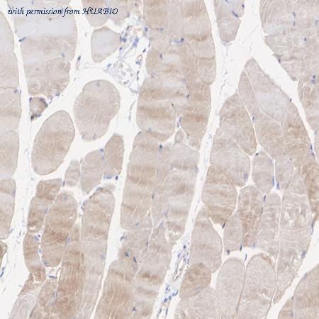 HUABIO ET1702-45 image 3