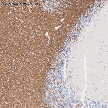 HUABIO ET1702-46 image 3