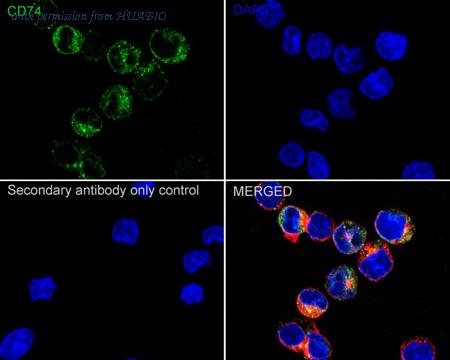 HUABIO ET1702-51 image 2