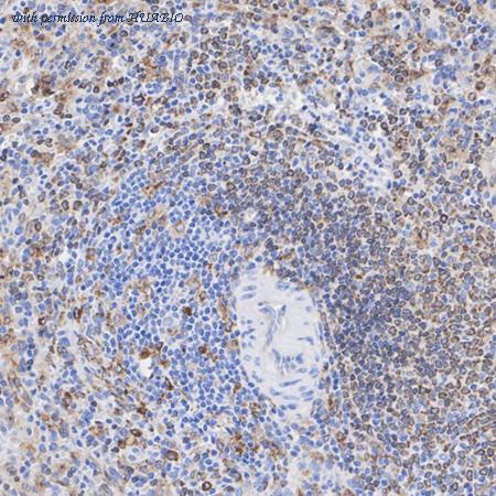 HUABIO ET1702-51 image 3