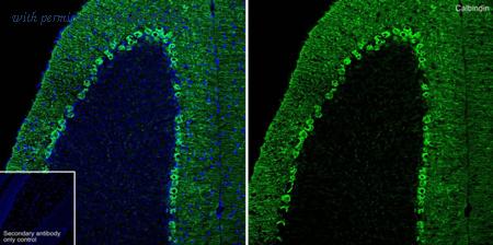 HUABIO ET1702-54 image 1