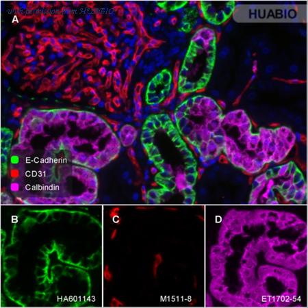 HUABIO ET1702-54 image 3