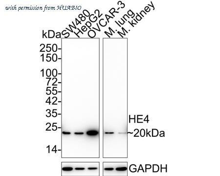 HUABIO ET1702-61 image 1