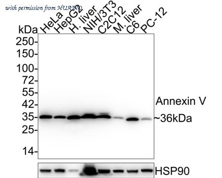 HUABIO ET1702-62 image 1