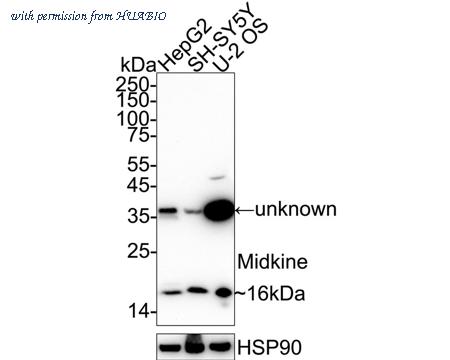 HUABIO ET1702-64 image 1