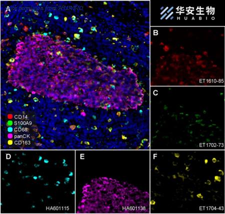 HUABIO ET1702-73 image 1