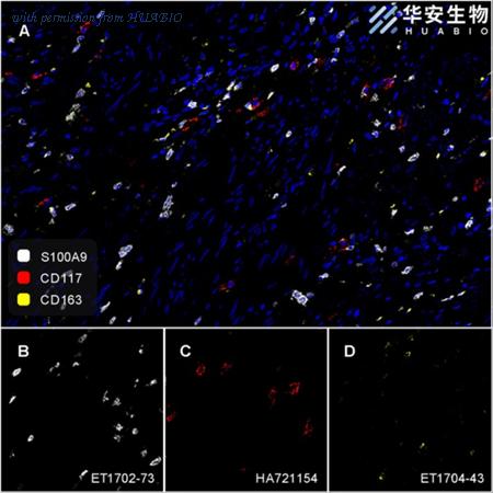 HUABIO ET1702-73 image 2