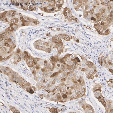 HUABIO ET1702-73 image 3