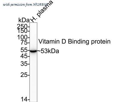 HUABIO ET1703-09 image 1