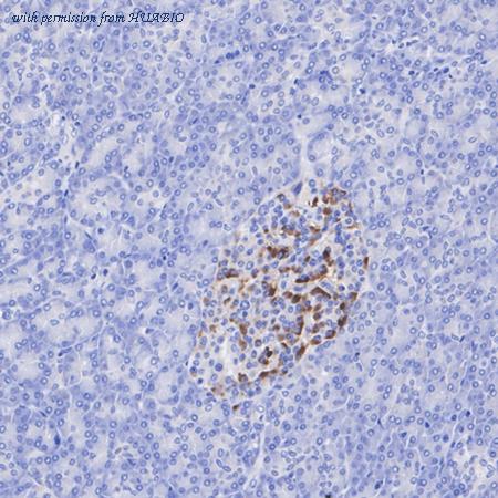 HUABIO ET1703-09 image 2