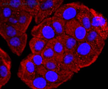 HUABIO ET1703-09 image 3