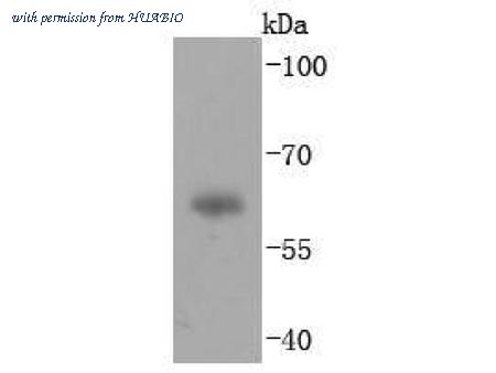 HUABIO ET1703-10 image 1