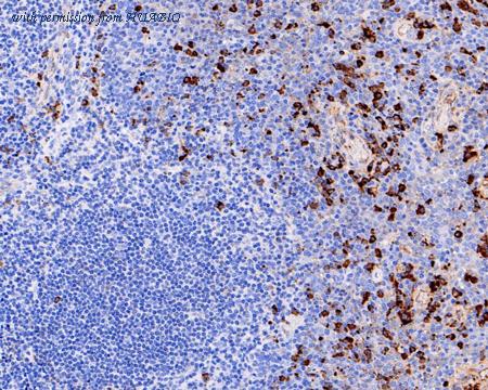 HUABIO ET1703-10 image 2