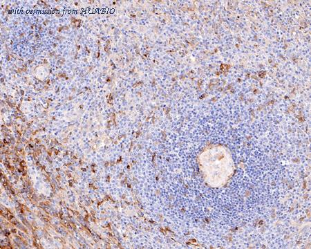 HUABIO ET1703-10 image 3