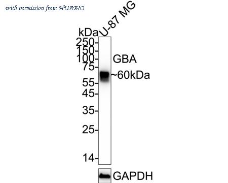 HUABIO ET1703-32 image 2