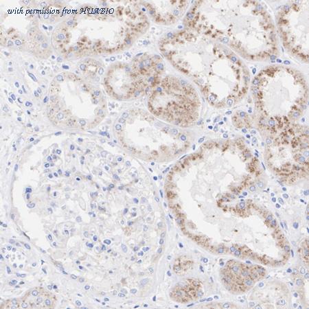 HUABIO ET1703-32 image 3