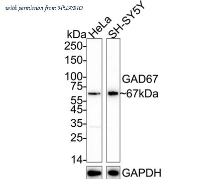 HUABIO ET1703-71 image 1
