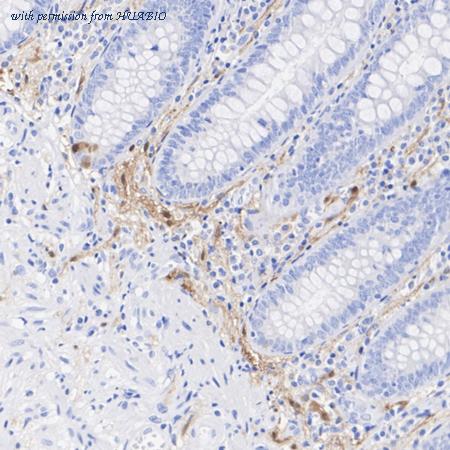 HUABIO ET1703-72 image 2