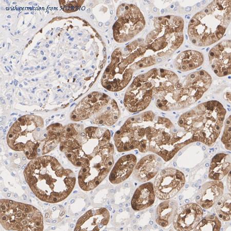 HUABIO ET1703-72 image 3