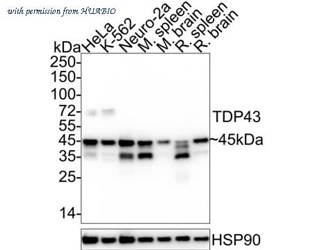 HUABIO ET1703-74-50UL image 1