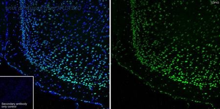 HUABIO ET1703-74-50UL image 2