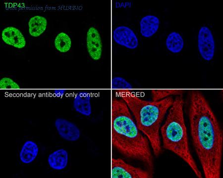 HUABIO ET1703-74-50UL image 3