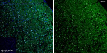 HUABIO ET1703-75-50UL image 2