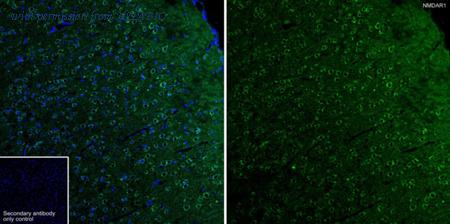 HUABIO ET1703-75-50UL image 3