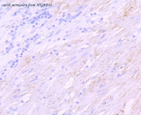 HUABIO ET1703-88 image 2