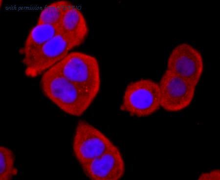 HUABIO ET1703-92 image 3