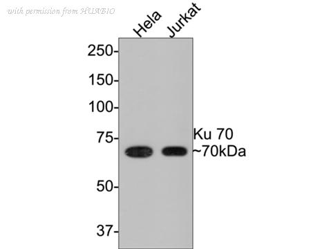 HUABIO ET1703-95 image 1