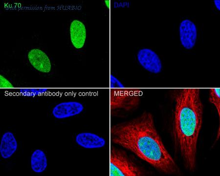 HUABIO ET1703-95 image 2