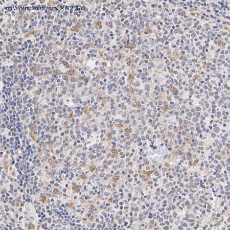 HUABIO ET1703-95 image 3